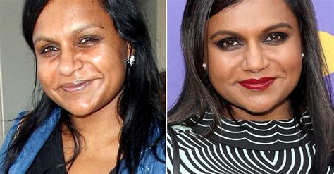 mindy kaling plastic surgery|Mindy Kaling’s Plastic Surgery – What We Know So Far